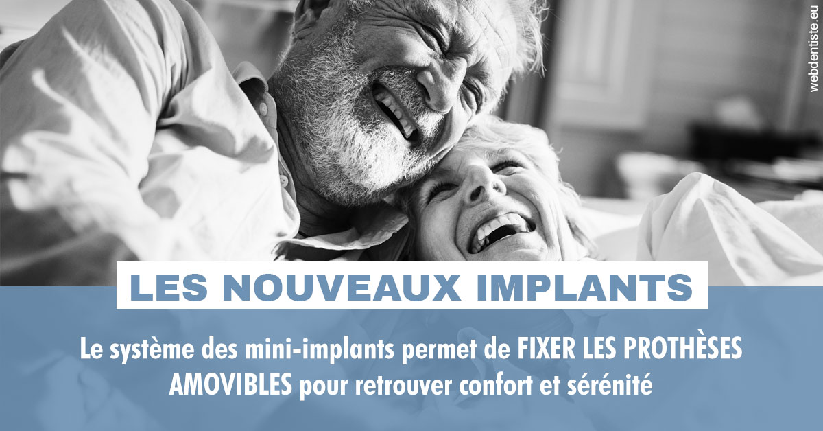 https://dr-trin-yves.chirurgiens-dentistes.fr/Les nouveaux implants 2