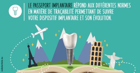https://dr-trin-yves.chirurgiens-dentistes.fr/Le passeport implantaire