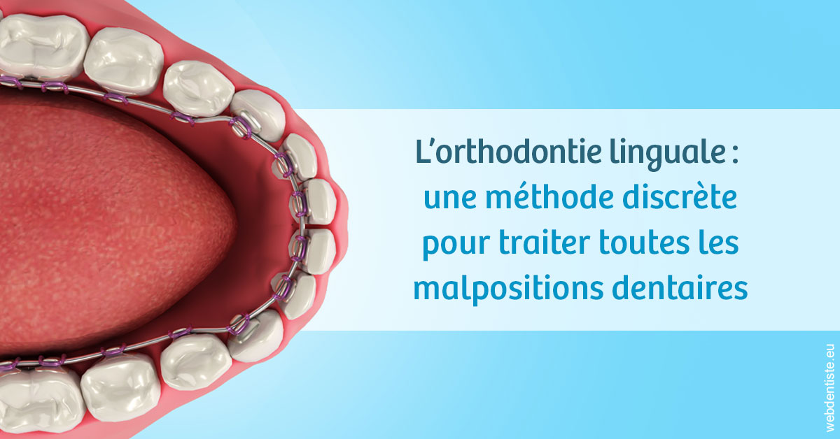 https://dr-trin-yves.chirurgiens-dentistes.fr/L'orthodontie linguale 1