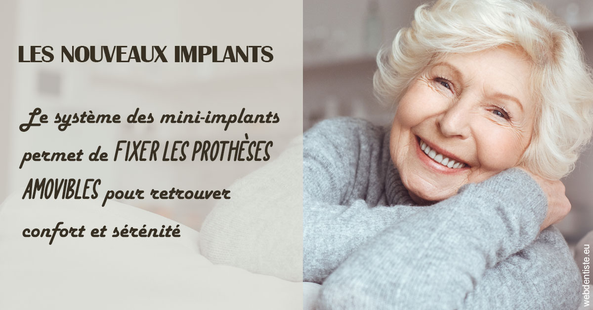 https://dr-trin-yves.chirurgiens-dentistes.fr/Les nouveaux implants 1
