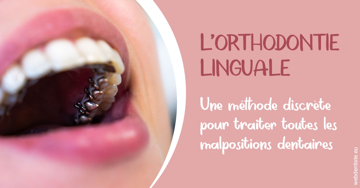 https://dr-trin-yves.chirurgiens-dentistes.fr/L'orthodontie linguale 2