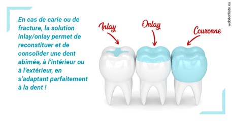 https://dr-trin-yves.chirurgiens-dentistes.fr/L'INLAY ou l'ONLAY