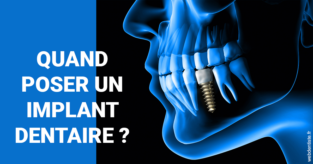 https://dr-trin-yves.chirurgiens-dentistes.fr/Les implants 1