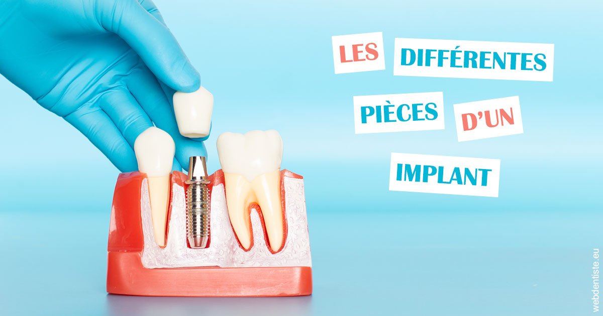 https://dr-trin-yves.chirurgiens-dentistes.fr/Les différentes pièces d’un implant 2