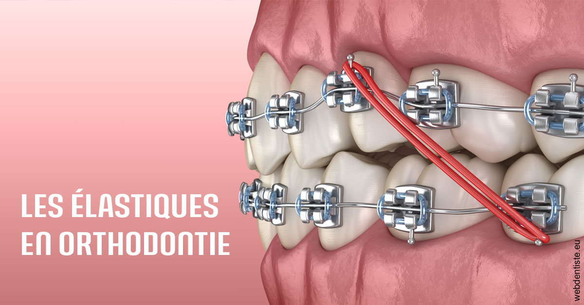 https://dr-trin-yves.chirurgiens-dentistes.fr/Elastiques orthodontie 2