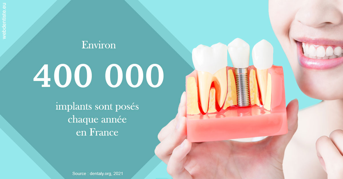https://dr-trin-yves.chirurgiens-dentistes.fr/Pose d'implants en France 2